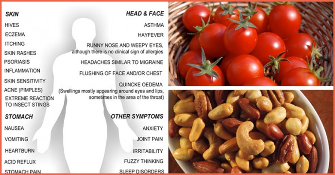 histamine intolerance