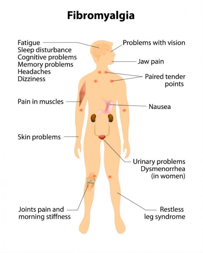 cannabis patch to treat fibromyalgia