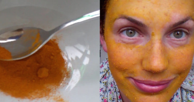 turmeric face mask, natural remedies for acne