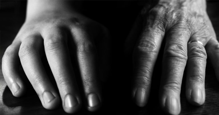 4 Reasons Your Hands Look Older Than They Are—And What You Can Do About It - Featured image