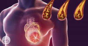 Illustration of the internal workings of human arteries