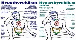 Signs, Symptoms, Triggers, and Natural Approaches to Hypo and Hyperthyroidism hypothyroidism and hyperthyroidism symptoms