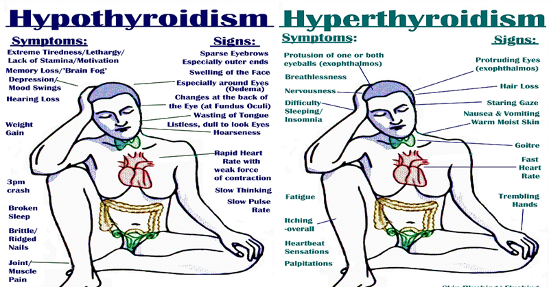 hypothyroidism and hyperthyroidism symptoms
