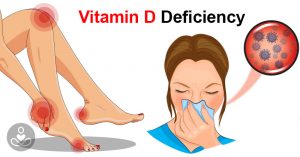 Signs You’re Lacking in Vitamin D and How to Get More To Boost Your Immunity Sep10_Part04_02_Vitamin-D