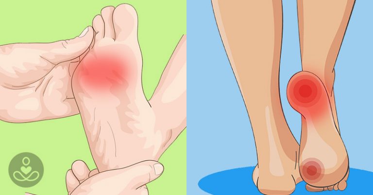 6 hidden causes of foot pain and how to get relief fast - Featured image