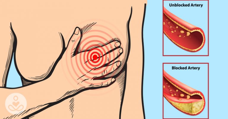 9 Foods You Should Eat Regularly To Support Your Arterial Health - Featured image