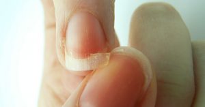 THS_June_12_08_Brittle_nails