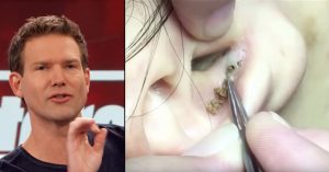 Doctors Warn: Wearing Headphones Too Long Could Cause Blackheads In Ear THS_Dec11_Part04_02_Doctors-Warn-That-Wearing-Headphones-for-Too-Long-Could-Cause-Blackheads-Inside-Your-Ear