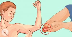 10 Signs Of Protein Deficiency That Everyone Should Know THS_June_05_Monday_04_Protein_deficiency