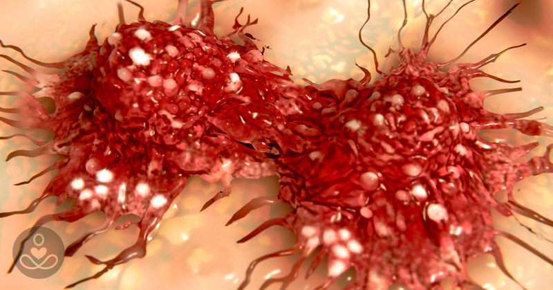 cancer cell representation.