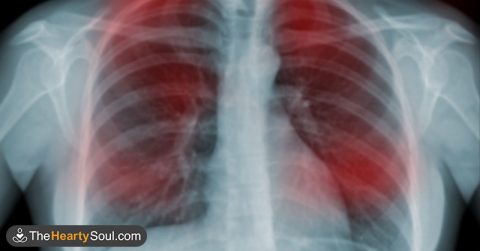 7 warning signs of cancer