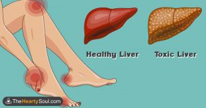 toxic liver