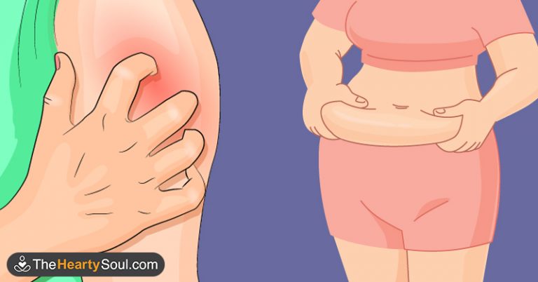 14 Signs Your Blood Sugar Is Way Too High - Featured image