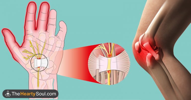 10 Signs You Should Pay More Attention To Your Thyroid Health - Featured image