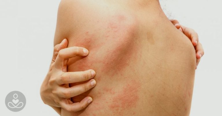 Stressed? This is how it physically damages your body and causes back pain - Featured image
