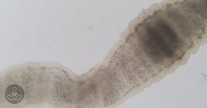 May28_Part01_04(Site)_Tapeworm