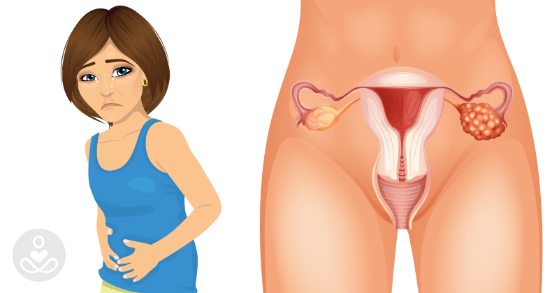 illustration of woman holding abdomen and the anatomy of female reproductive system including vaginal canal, ovaries. Ovarian cancer symptoms concept
