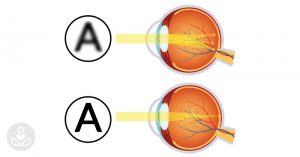 10 simple and relaxing eye exercises you should do after looking at a screen THS Virals_Mar 10_simple and relaxing eye exercises