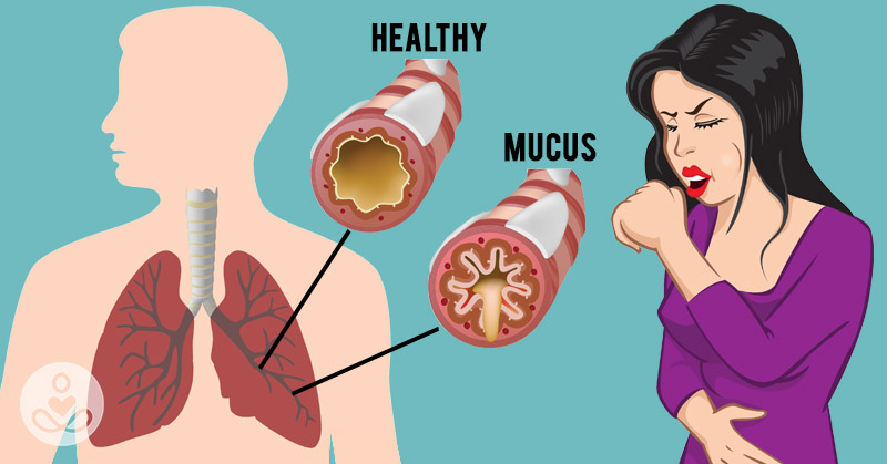 how to get rid of mucus in chest, how to get rid of mucus in lungs, how to get rid of phlegm in chest, how to get rid of mucus in lungs fast