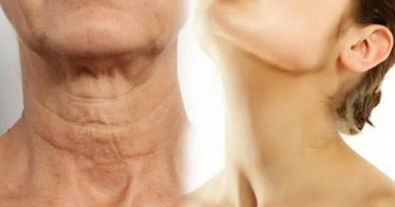 wrinkly neck and youthful neck