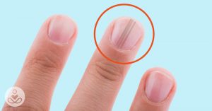What Does Skin Cancer Look Like? Watch Out For These 7 Symptoms skin cancer symptoms