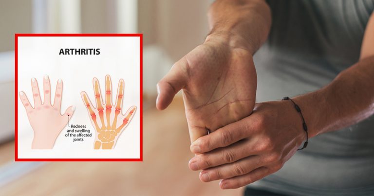 Do These Hand Exercises In The Morning to Relieve Arthritis Pain In Your Wrists and Fingers - Featured image