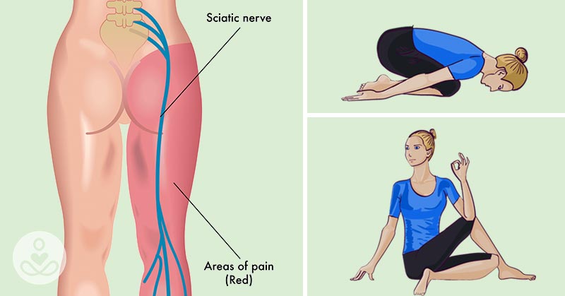 yoga for sciatica, sciatica stretches