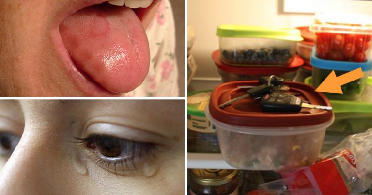 Vitamin B12 Deficiency Symptoms that Most People Ignore - Featured image