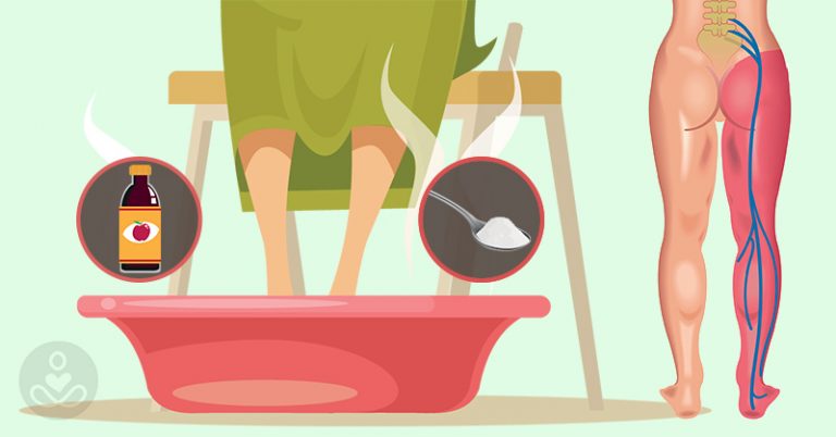 Try this Simple and Effective Method to Help Relieve Sciatic Nerve Pain - Featured image