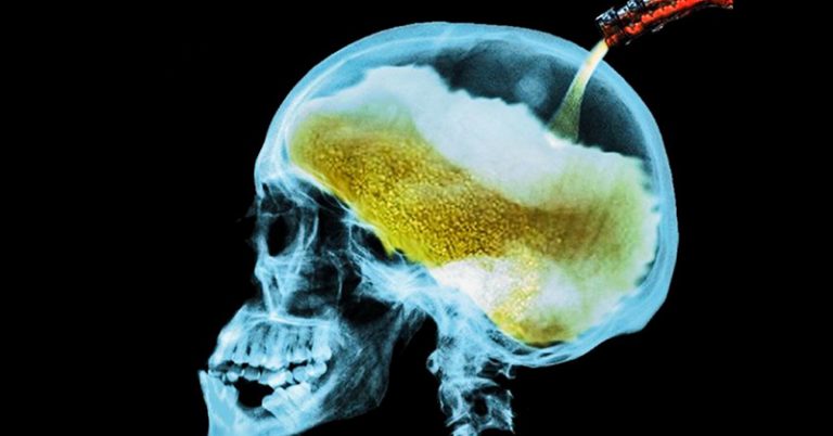 What Alcohol Consumption Does to Your Brain - Featured image