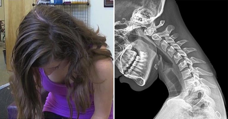‘Text Neck’ Is Real: Do These 6 Stretches to Prevent Your Spine from Degeneration - Featured image