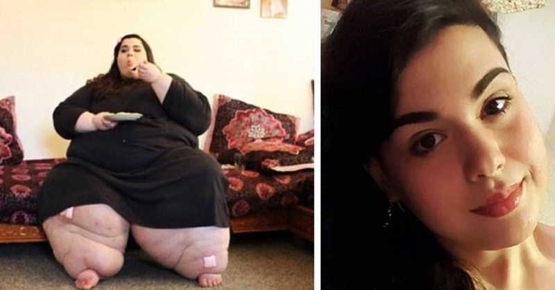 Amber Rachdi before and after | My 600 pound life