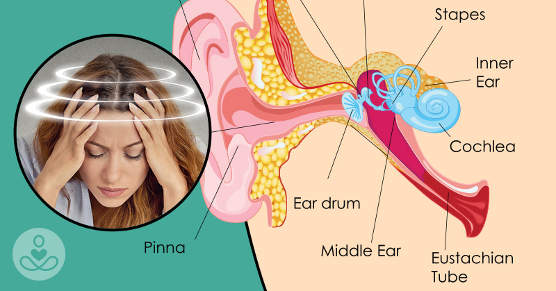 7 Ways to Get Rid of Vertigo Before It Becomes a Chronic Problem - Featured image