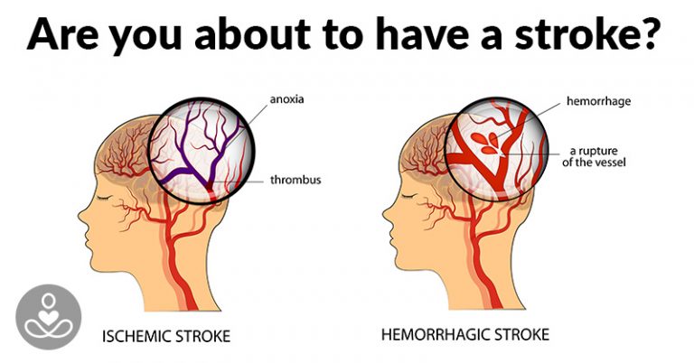 How To Prevent A Stroke Before It’s Too Late - Featured image