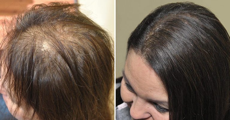 The Best Shampoos for Anyone Who Has Thinning Hair - Featured image
