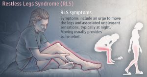 8 Yoga Poses to Calm Restless Legs Syndrome THS_Sep11_Part02_04_Repub_Restless-Legs-Syndrome