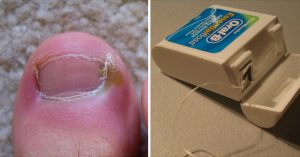 THS_Sep18_Part02_07_Tested_Ingrown-Toenails
