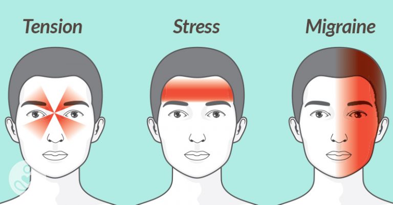 How to Help Relieve Any Headache in 10 Minutes Without Pills - Featured image