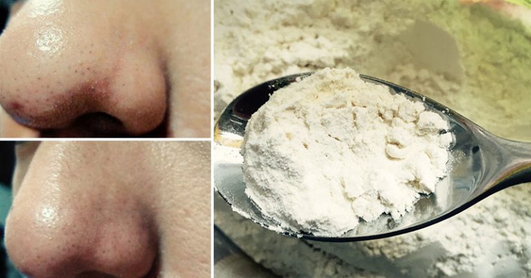 15 Natural Remedies to Help Your Skin Stay Young - Featured image
