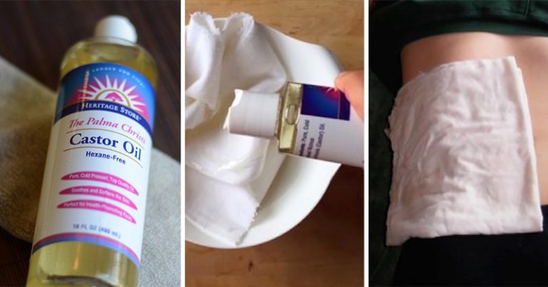6 Ways Castor Oil May Benefit Your Health - Featured image