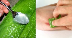 Miracle Medicinal Plant: 17 Ways to Use Aloe Vera for Health and Beauty THS_Oct30_Part03_06_Miracle-Medicinal-Plant--17-Ways-to-Use-Aloe-Vera-for-Health-and-Beauty