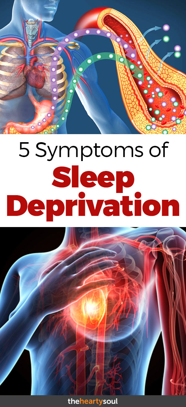5 Symptoms of Sleep Deprivation - Cover Image