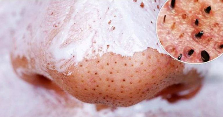 Want better skin? Try this DIY coconut oil baking soda facial cleanser - Featured image