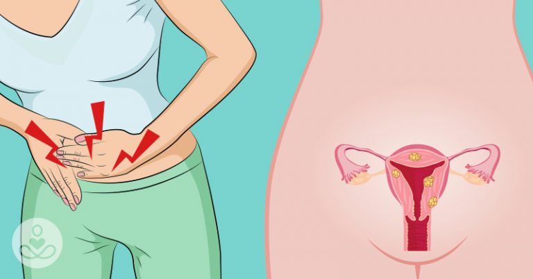 4 Severe Signs of Cervical Cancer You Should Never Ignore, But Many Women Do - Featured image