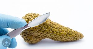 Why Pancreatic Cancer Is On the Rise pancreatic cancer