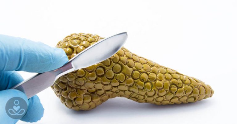 Why Pancreatic Cancer Is On the Rise - Featured image