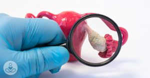 Gloved hand with a magnifying glass to a model of affected ovaries