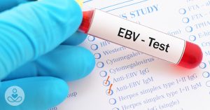 Study Links Mono Virus to Several Serious Diseases April23_Part01_02_Mono-linked-to-diseases