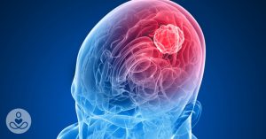 May14_Part03_03(Site)_5-brain-tumor-symptoms