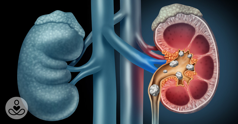 Illustration of a human kidney